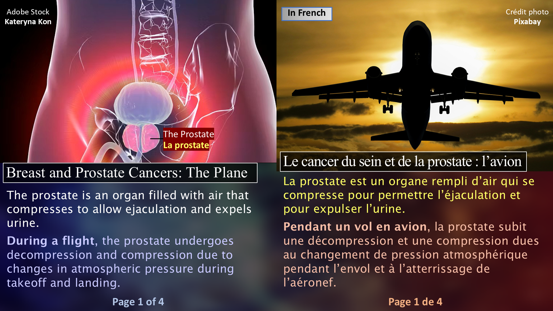 Breast and Prostate Cancers: The Plane / Le cancer du sein et de la prostate : l’avion - Page 01